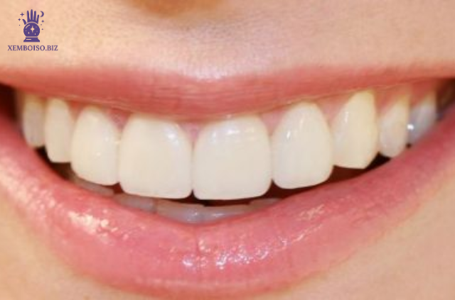 Những người có răng cửa khít thường có mối quan hệ tình cảm bền chặt