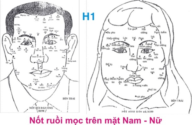 Bói Tướng Nốt Ruồi là Gì? Vì Sao Nên Tìm Hiểu?
